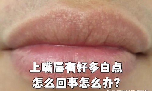月经期可以吃糖吗-【月经期可以吃糖吗】月经期间可以吃塘虱吗女生 - 月经期间可以吃塘虱吗网